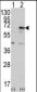 PKR (PRKR) Antibody (C-term)